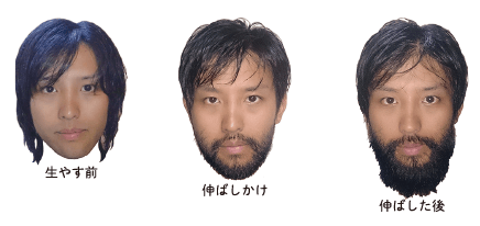 髭